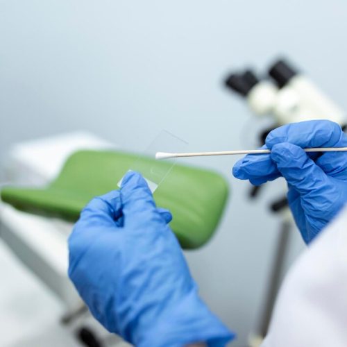 vaginal-smear-closeup-doctor-hand-holds-gynecological-examination-instruments-gynecologist-working-obstetrics-gynecology-clinic_657921-145